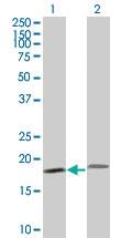 Anti-PTH Mouse Monoclonal Antibody [clone: 3H7]