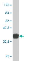 Anti-CD34 Mouse Monoclonal Antibody [clone: 5A6]