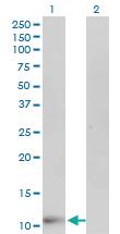 Anti-FABP6 Mouse Monoclonal Antibody [clone: 4A4]