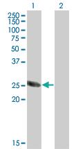 Anti-TSSK3 Mouse Monoclonal Antibody [clone: 6B2]