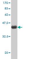 Anti-UBE2C Mouse Monoclonal Antibody [clone: 9D3]