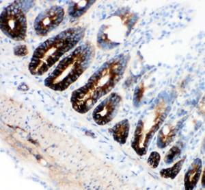 Anti-NKCC1 Rabbit Polyclonal Antibody