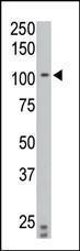 Anti-PTPIA2 beta Rabbit Polyclonal Antibody (AP (Alkaline Phosphatase))