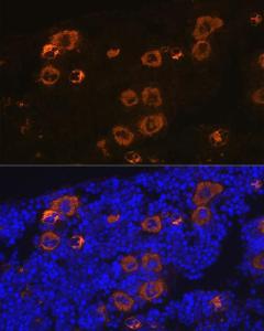 Immunofluorescence analysis of mouse bone marrow using Anti-PF4 Antibody [ARC2076] (A307846) at a dilution of 1:100 (40X lens). DAPI was used to stain the cell nuclei (blue)