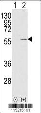 Anti-VIM Rabbit Polyclonal Antibody