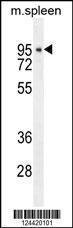 Anti-DTL Rabbit Polyclonal Antibody (AP (Alkaline Phosphatase))