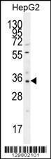 Anti-OR52I2 Rabbit Polyclonal Antibody (FITC (Fluorescein Isothiocyanate))