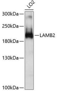 Western blot analysis of extracts of LO2 cells, using Anti-Laminin beta 2 Antibody (A8653) at 1:1,000 dilution