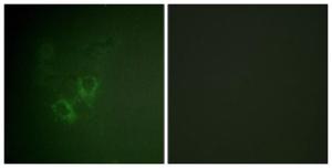 Immunofluorescence analysis of HeLa cells using Anti-AhR Antibody. The right hand panel represents a negative control, where the antibody was pre-incubated with the immunising peptide.