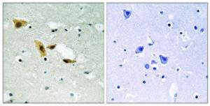 Immunohistochemical analysis of paraffin-embedded human brain tissue using Anti-APLF Antibody. The right hand panel represents a negative control, where the antibody was pre-incubated with the immunising peptide