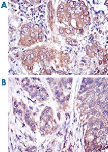 Anti-MAPK3 Mouse Monoclonal Antibody [clone: 1E5]