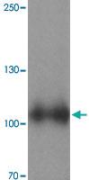 Anti-SIPA1 Rabbit Polyclonal Antibody