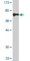 Anti-CDR2 Mouse Monoclonal Antibody [clone: 4D2]