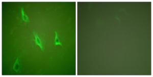 Immunofluorescence analysis of HeLa cells using Anti-Caspase 10 Antibody. The right hand panel represents a negative control, where the antibody was pre-incubated with the immunising peptide