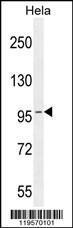 Anti-COG3 Rabbit Polyclonal Antibody (Biotin)