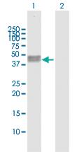 Anti-CA12 Rabbit Polyclonal Antibody