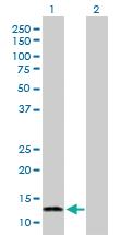 Anti-FABP7 Rabbit Polyclonal Antibody