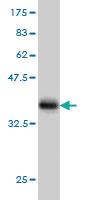 Anti-AKT3 Mouse Monoclonal Antibody [clone: 6F12]