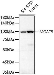 Western blot analysis of extracts of various cell lines, using Anti-MGAT5 Antibody (A8655) at 1:500 dilution. The secondary antibody was Goat Anti-Rabbit IgG H&L Antibody (HRP) at 1:10,000 dilution. Lysates/proteins were present at 25µg per lane.