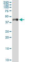 Anti-CA12 Rabbit Polyclonal Antibody