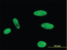 Anti-MLLT1 Mouse Monoclonal Antibody [clone: 3H2]