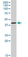 Anti-CA12 Rabbit Polyclonal Antibody