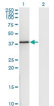 Anti-DNAJB6 Mouse Monoclonal Antibody [clone: 1A5]