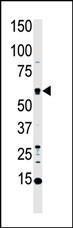 Anti-MST1 Rabbit Polyclonal Antibody (HRP (Horseradish Peroxidase))