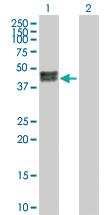 Anti-CA12 Rabbit Polyclonal Antibody