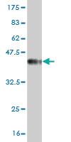 Anti-PIK3C2B Mouse Monoclonal Antibody [clone: 3E5]