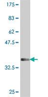 Anti-ADGRB2 Mouse Polyclonal Antibody