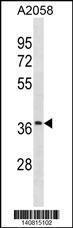 Anti-OR52J3 Rabbit Polyclonal Antibody (AP (Alkaline Phosphatase))