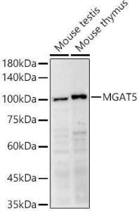 Western blot analysis of extracts of various cell lines, using Anti-MGAT5 Antibody (A8655) at 1:500 dilution. The secondary antibody was Goat Anti-Rabbit IgG H&L Antibody (HRP) at 1:10,000 dilution. Lysates/proteins were present at 25µg per lane.