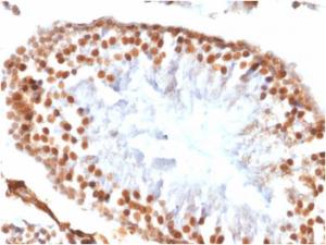 Immunohistochemical analysis of formalin-fixed, paraffin-embedded rat testis using Anti-Wilms tumor Protein Antibody [WT1/1434R]