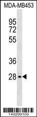 Anti-MLST8 Rabbit Polyclonal Antibody (AP (Alkaline Phosphatase))