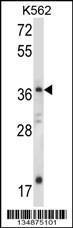 Anti-JMJD6 Rabbit Polyclonal Antibody (PE (Phycoerythrin))