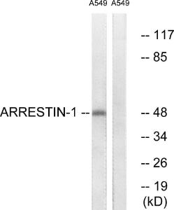 Antibody anti-arrestin 1 100 µg