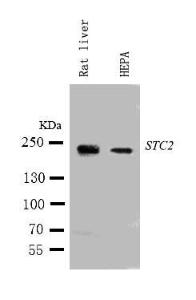 Anti-Tuberin Rabbit Polyclonal Antibody