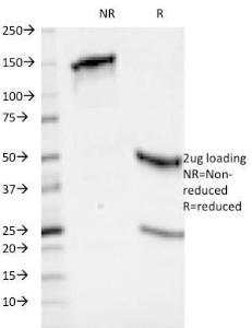 SDS-PAGE analysis of Anti-HLA ABC Antibody [246-B8.E7] under non-reduced and reduced conditions; showing intact IgG and intact heavy and light chains, respectively. SDS-PAGE analysis confirms the integrity and purity of the antibody