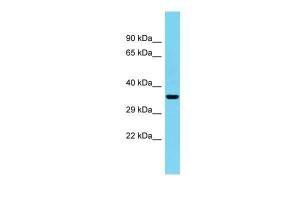 Anti-C1orf222 Rabbit Polyclonal Antibody