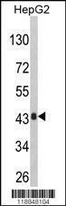 Anti-AGXT Rabbit Polyclonal Antibody (HRP (Horseradish Peroxidase))