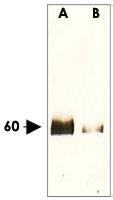 Anti-AKT1 Rabbit Polyclonal Antibody