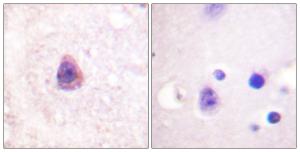 Antibody anti-arrestin 1 100 µg