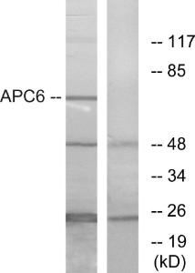 Western blot analysis of lysates from NIH/3T3 cells using Anti-APC6 Antibody. The right hand lane represents a negative control, where the antibody is blocked by the immunising peptide.