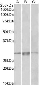 Anti-PRRX1 Antibody (A83326) (1µg/ml) staining of Human Heart lysate (35µg protein in RIPA buffer). Primary incubation was 1 hour. Detected by chemiluminescence.