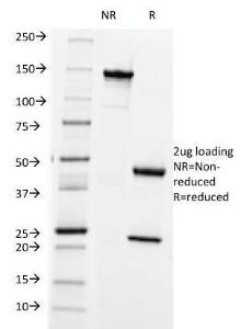 SDS-PAGE analysis of Anti-HLA ABC Antibody [SPM419] under non-reduced and reduced conditions; showing intact IgG and intact heavy and light chains, respectively. SDS-PAGE analysis confirms the integrity and purity of the antibody