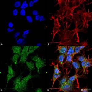 Immunocytochemistry/Immunofluorescence analysis of human neuroblastoma cell line (SK-N-BE, fixed in 4% formaldehyde for 15 min at room temperature, using Anti-UVRAG Antibody (A305064), at 1:100 for 60 minutes at room temperature