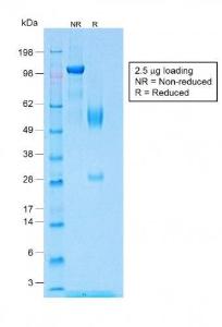 SDS-PAGE analysis of Anti-Wilms Tumor Protein Antibody [WT1/1434R] under non-reduced and reduced conditions; showing intact IgG and intact heavy and light chains, respectively. SDS-PAGE analysis confirms the integrity and purity of the Antibody