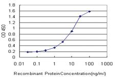 Anti-MAP1LC3B Mouse Monoclonal Antibody [clone: 4E11]