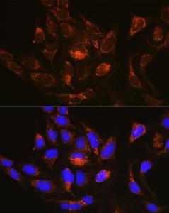 Immunofluorescence analysis of U-2 OS cells using Anti-RAB13 Antibody (A8656) at a dilution of 1:100 (40x lens). DAPI was used to stain the cell nuclei (blue).